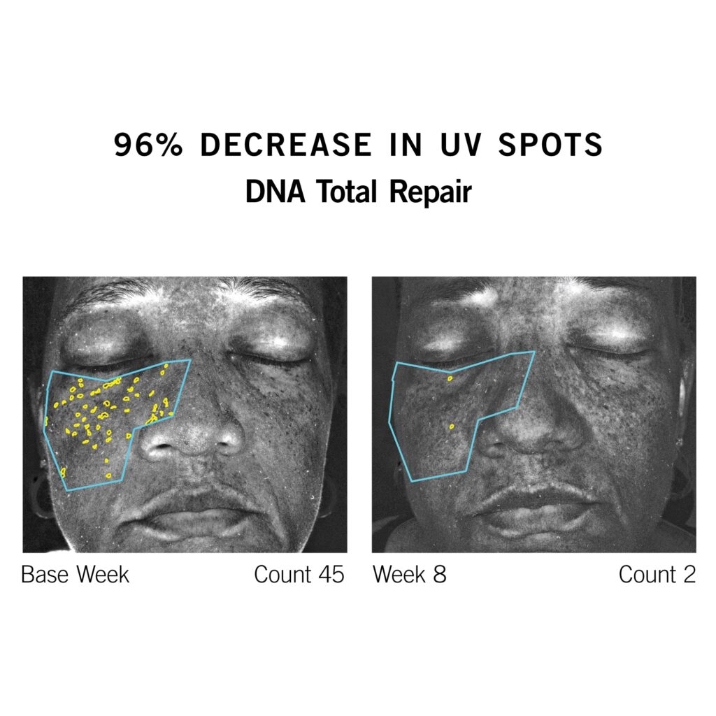 dna total repair